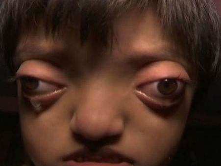 7 વર્ષની આ છોકરીને કેમ કહે છે લોકો એલિયન