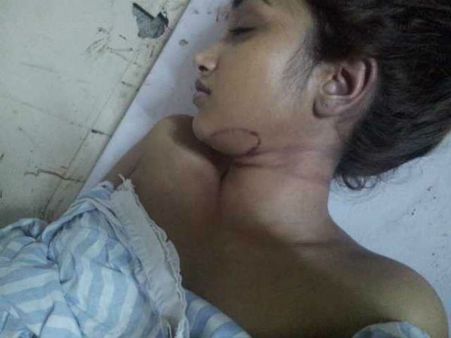 ગરદનનો નિશાન પહેલાનો ગરદનનો નિશાન પહેલાનો