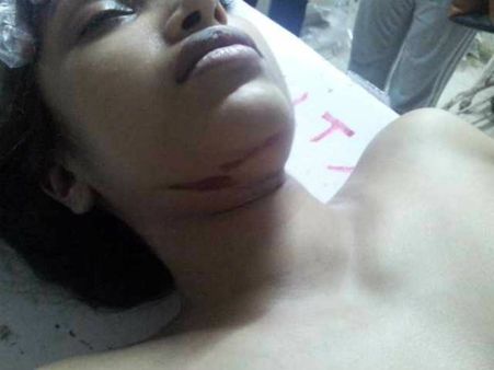 જમણા હોઠે ઈજા જમણા હોઠે ઈજા