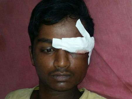 ઝરખે હુમલો કરતા ત્રણ યુવાનો ઘાયલ, એકની આંખ ખેંચી