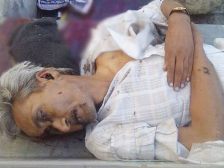 સ્ટોન કિલર નહીં અંગત અદાવત બની મોતનું કારણ 