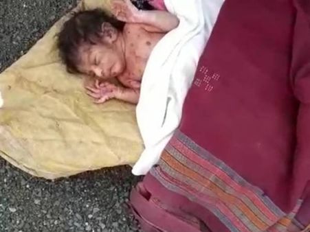 મોરબીમાં ગીચ ઝાડીમાંથી મળી આવી નવજાત બાળકી