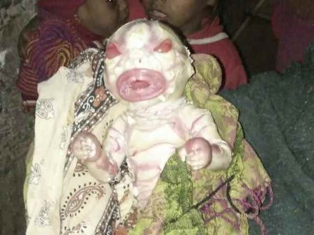 Viral Video: બિહારમાં એલિયન રૂપે જન્મ્યું બાળક, તમે ક્યારેય આવું બાળક જોયું નહીં હોય