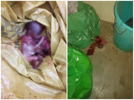 સિવિલ હોસ્પિટલની કચરાપેટીમાંથી મળ્યું મૃત બાળકનું ભ્રૂણ