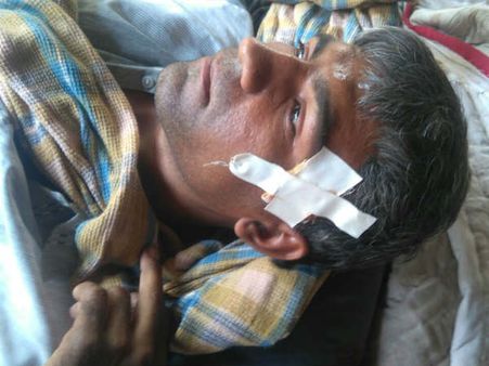 જો ચીસ ના પાડી હોત તો દિપડાએ ના કર્યો હોત હુમલો!