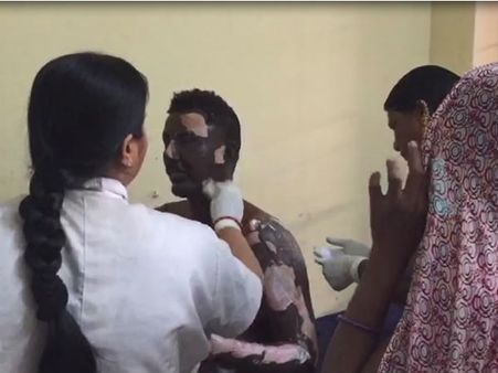 ગેસનો બોટલો ફાટતા એકજ પરિવારના ૧૦ લોકો દાઝ્યા