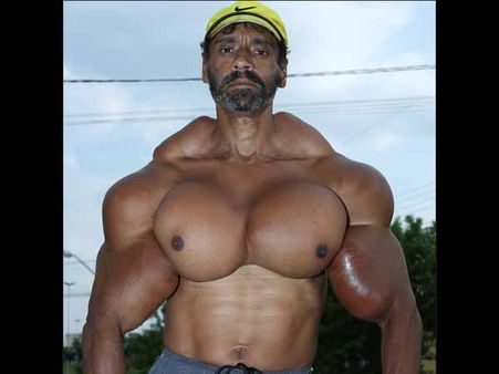 Bizarre: આ ભાઇ પોતાને તેલના ઇન્જેક્શન આપે છે, કારણ છે...