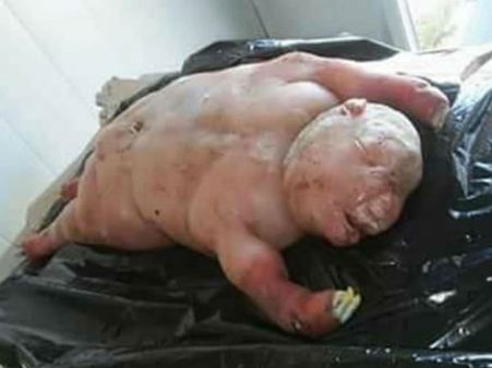 શું છે કારણ આ દેખાવનું? 