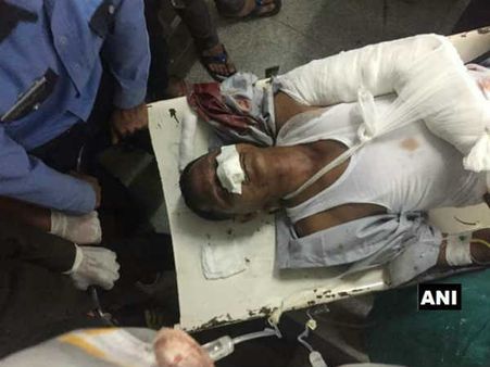 સાઇડ સીનની લાલચ અને ડ્રાઇવરની ભૂલ