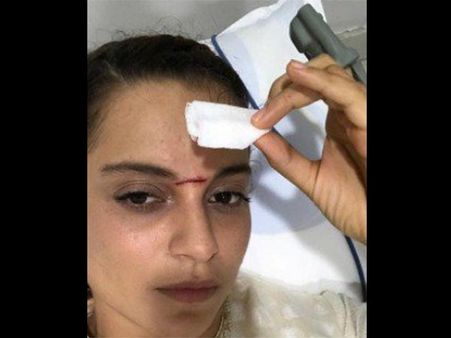 કપાળ પર થઇ ઇજા કપાળ પર થઇ ઇજા