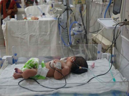 21 બાળકોની મોત, CM એ લીધી મુલાકાત તો કોંગ્રેસે કર્યો વિરોધ