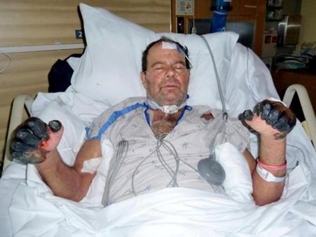 પોલની તસવીર 