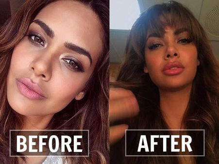 હોઠમાં લાગે છે ફેરફાર