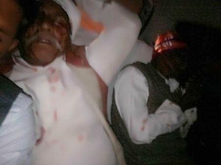 યુપી: રોડ દુર્ઘટનામાં આપના દળના ઘણા નેતા ઘાયલ