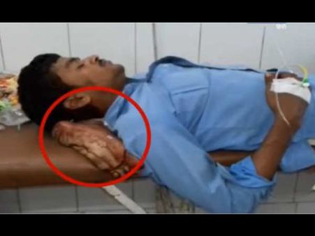 Viral Video :દર્દીનો પગ કાપી તેના જ માથા નીચે તકિયાની જેમ મૂક્યો