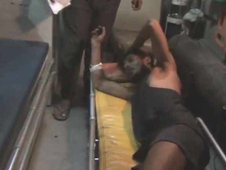 લગ્ન નહીં કર્યા તો 6 બાળકોની માતાએ પ્રેમી પર એસિડ ફેંક્યું