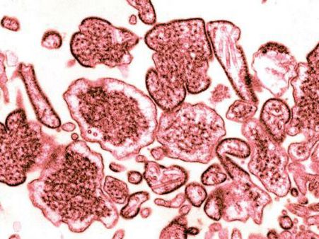 શું છે ‘નિપાહ વાયરસ’ ?