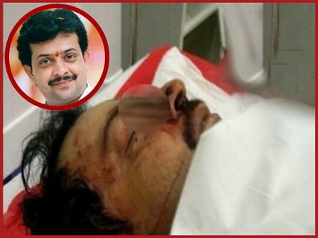 મૃત્યુ પછી ભૈયુજી મહારાજની પહેલી ફોટો, માથા પર મારી હતી ગોળી