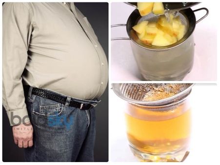 મેદસ્વીતાને દૂર કરવાના ઉપાય મેદસ્વીતાને દૂર કરવાના ઉપાય