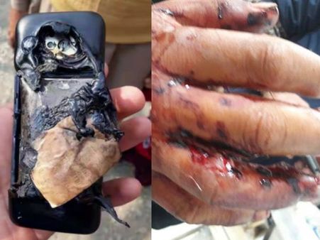 ગેમ રમતી વખતે મોબાઈલ ફોનની બેટરીમાં ધમાકો, બાળક ઘાયલ