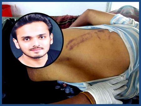 છાત્ર યશે કરી હતી આત્મહત્યા