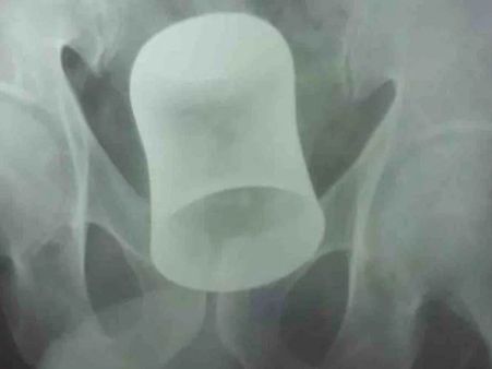 બદમાશોએ મારપીટ કર્યા બાદ નાખ્યો હતો ગ્લાસ બદમાશોએ મારપીટ કર્યા બાદ નાખ્યો હતો ગ્લાસ