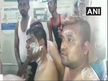 કર્ણાટક સ્થાનિક ચૂંટણીઃ કોંગ્રેસના ઉમેદવારની જીતના જશ્નમાં થયો એસિડ અટેક