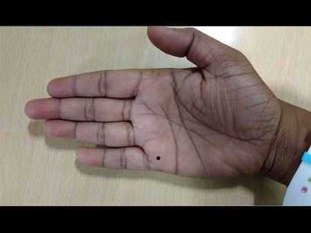 હથેળી પર બનેલી લગ્નની રેખા પર તલ