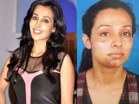 ફ્લોરા સૈનીએ શું લખ્યુ છે પોસ્ટમાં?