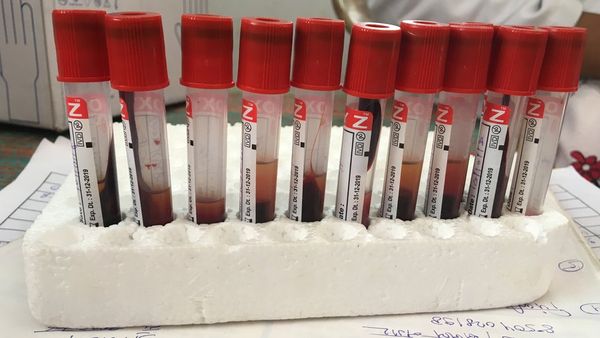 ખાસ ટાર્ગેટ મહિલાઓ