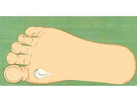 પગમાં શંખ કે માછલી