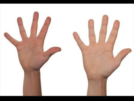 જાળી આકારનું ચિહ્ન