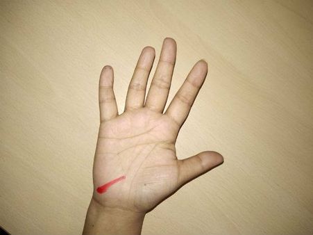 તૂટેલી જીવનરેખા