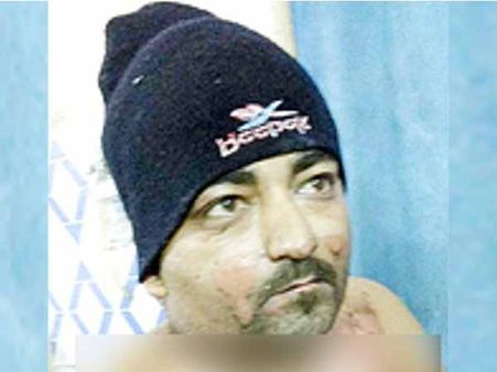 જૂનાગઢઃ પત્ની સાથેના દરરોજના ઝઘડાથી કંટાળી યુવકે અગ્ની સ્નાન કરી લીધું