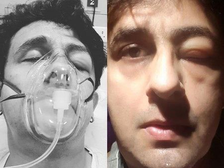 કેવી રીતે થઈ સોનુની આ હાલત