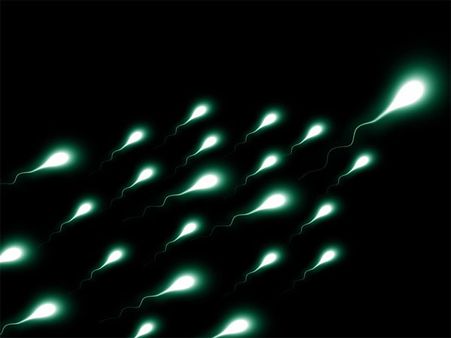 શુક્રાણુઓનો અભાવ