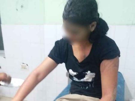 ડ્યુટી પર જઈ રહેલી મહિલા સિપાહી પર એસિડ એટેક, હાલત ગંભીર