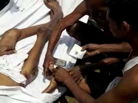 સંપત્તિ માટે મરેલા ભાઈના અંગૂઠાના નિશાન લઈ રહ્યો હતો નાનો ભાઈ, ફોટો વાયરલ