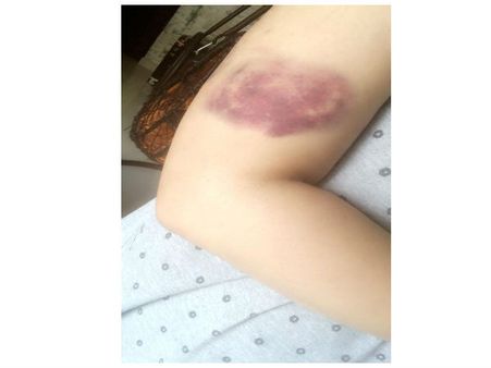 શુભી સાથે મારપીટની તસવીર