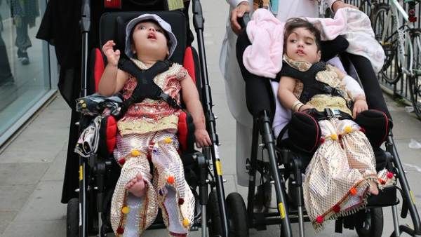 55 કલાક અને 3 ઓપરેશન બાદ અલગ થઈ દિમાગથી જોડાયેલ બે બહેનો