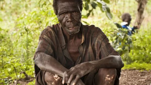 સરકાર આ રોગની સારવાર કરવા માંગી પરંતુ ...