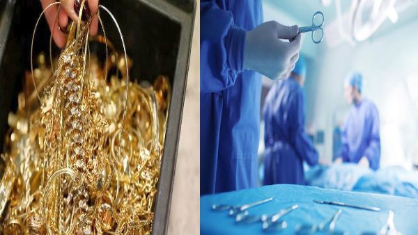 મહિલાના પેટમાંથી 1.5 કિલો જવેલરી નીકળી, 90 સિક્કાઓ નીકળ્યા