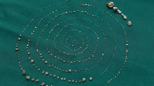 બાળકને 3 વર્ષની ઉંમરથી હતી તકલીફ બાળકને 3 વર્ષની ઉંમરથી હતી તકલીફ