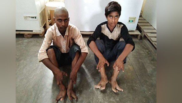 પગમાં હાથ જેવી આંગળીઓ, આ કુટુંબ દુર્લભ રોગ સાથે સંઘર્ષ કરી રહ્યું છે