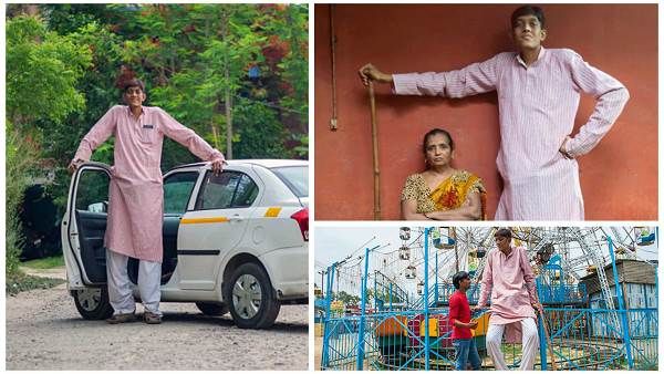 દેશનો સૌથી લાંબો માણસ, અમદાવાદમાં મફત સારવાર કરાવ્યા બાદ ચાલવા લાગ્યો