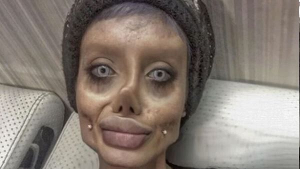 એન્જેલીના જેવું દેખાવા માટે કરાવી હતી 50 સર્જરી, હવે આ આરોપમાં ધરપકડ