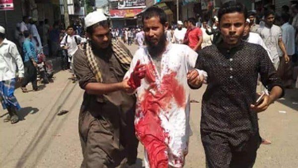 ફેસબૂક પોસ્ટને કારણે બાંગ્લાદેશમાં હિંસા ભડકી, 4 લોકોની મૌત 50 ઘાયલ