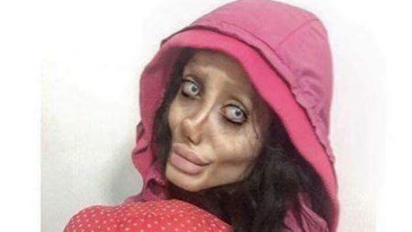 કોસ્મેટિક સર્જરી એકદમ લોકપ્રિય છે