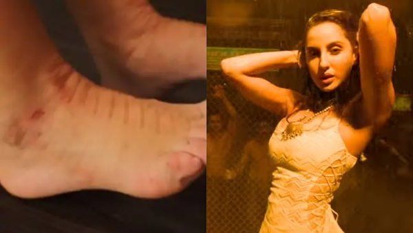 ફતેહીએ શેર કર્યો વીડિયો ફતેહીએ શેર કર્યો વીડિયો