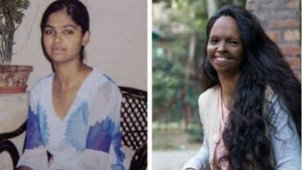 રસ્તા પર પડી રહી 